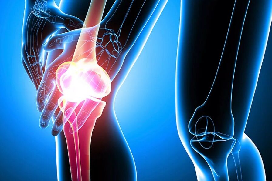 Knee articulation