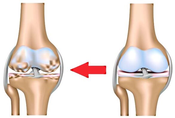 Healthy joint and arthritis