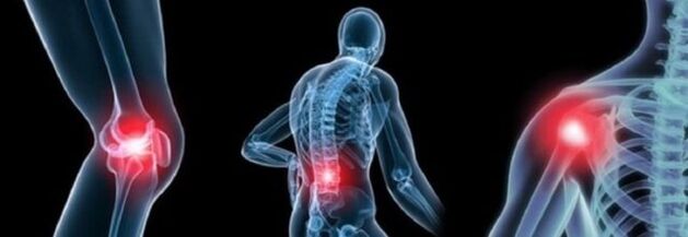 Types of Pain with Arthrine