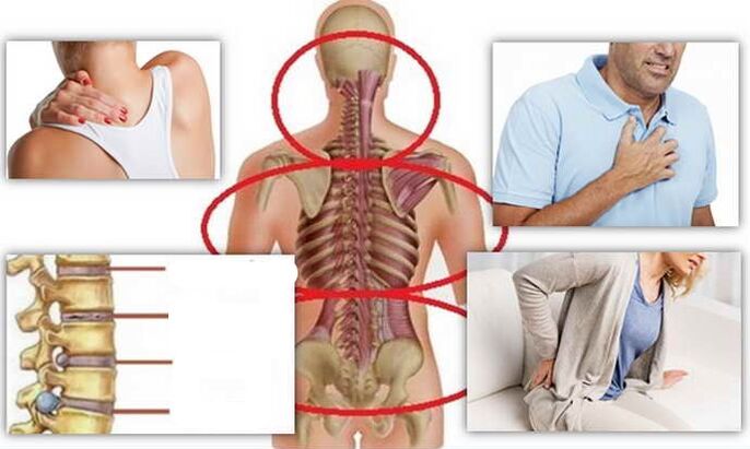 Disease positions for osteochondria